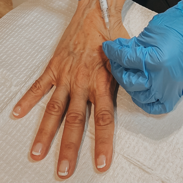 injecting on backside of hand of a women