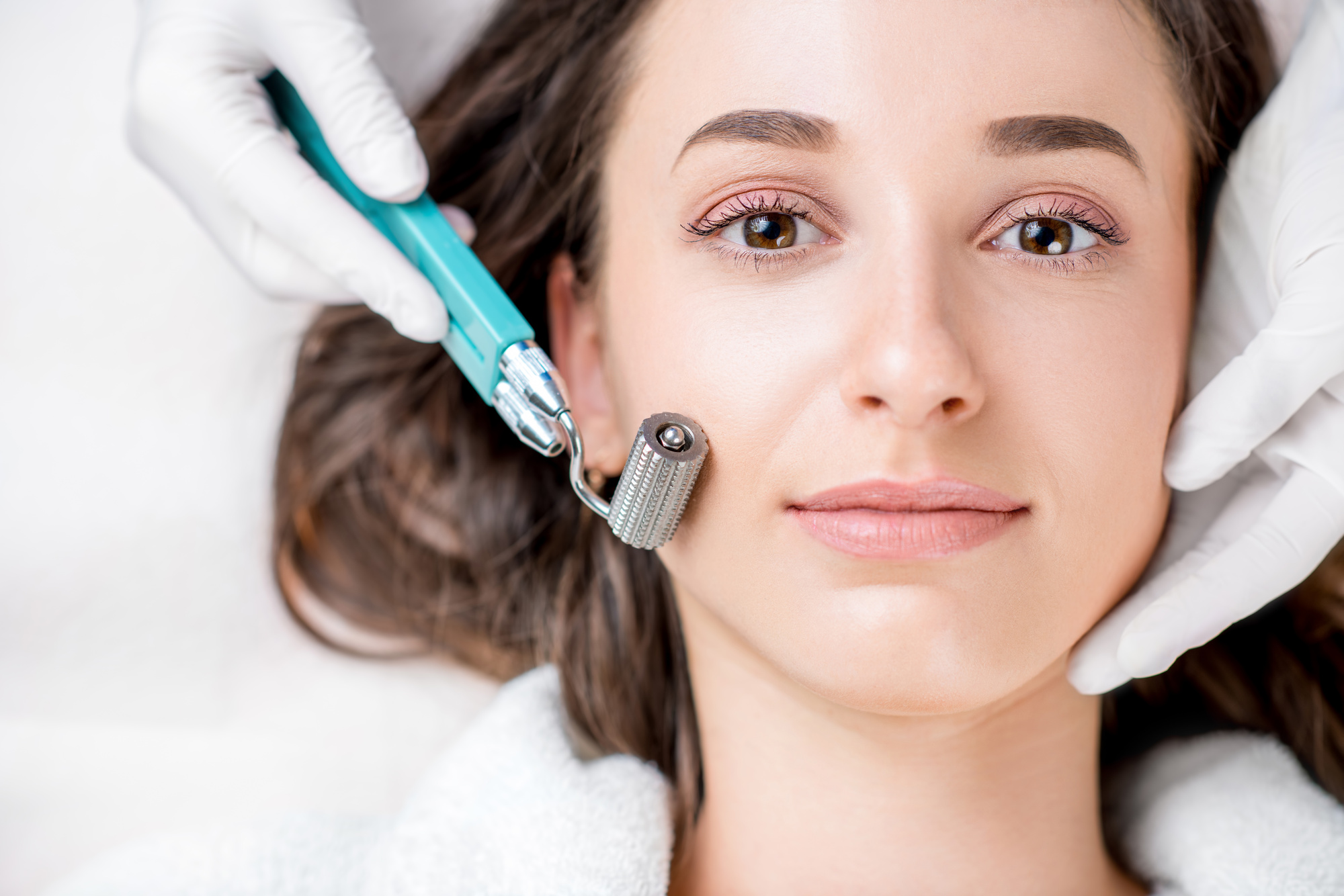 What Is Microneedling? A Quick Guide