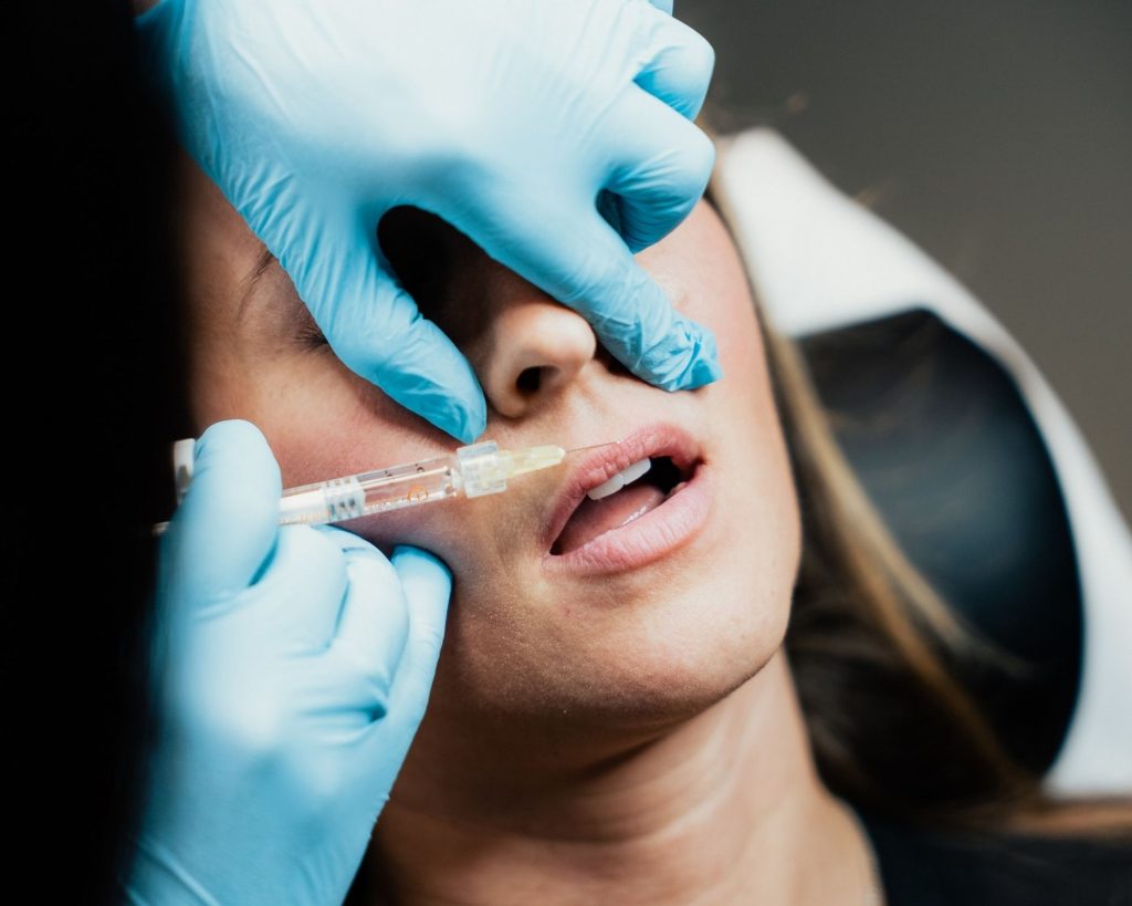 Lip Filler