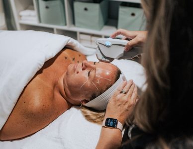 ULTHERAPY PRIME 2